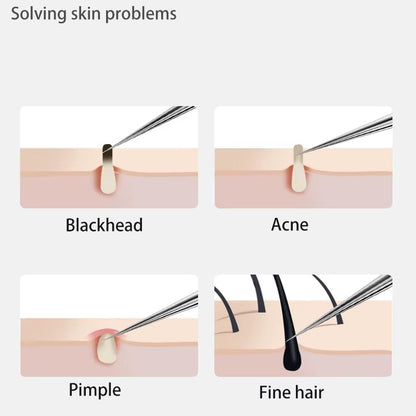 Stainless Steel Blackhead Remover Tool