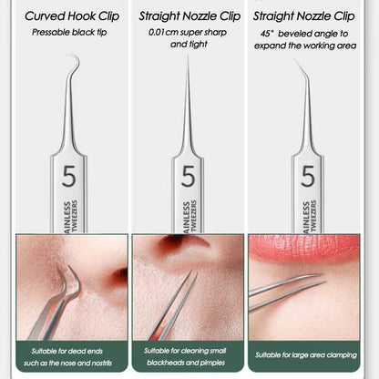 Stainless Steel Blackhead Remover Tool