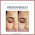 Eucerin Anti-Pigment Dual Face Serum for Pigmentation & Dark Spots 30ml